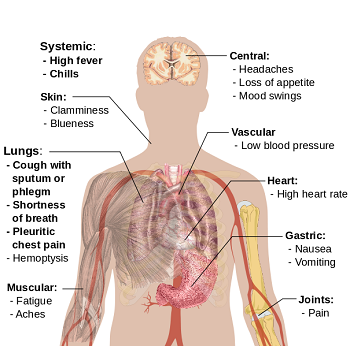 Pyothorax symptoms affecting lungs, heart, skin and other body systems