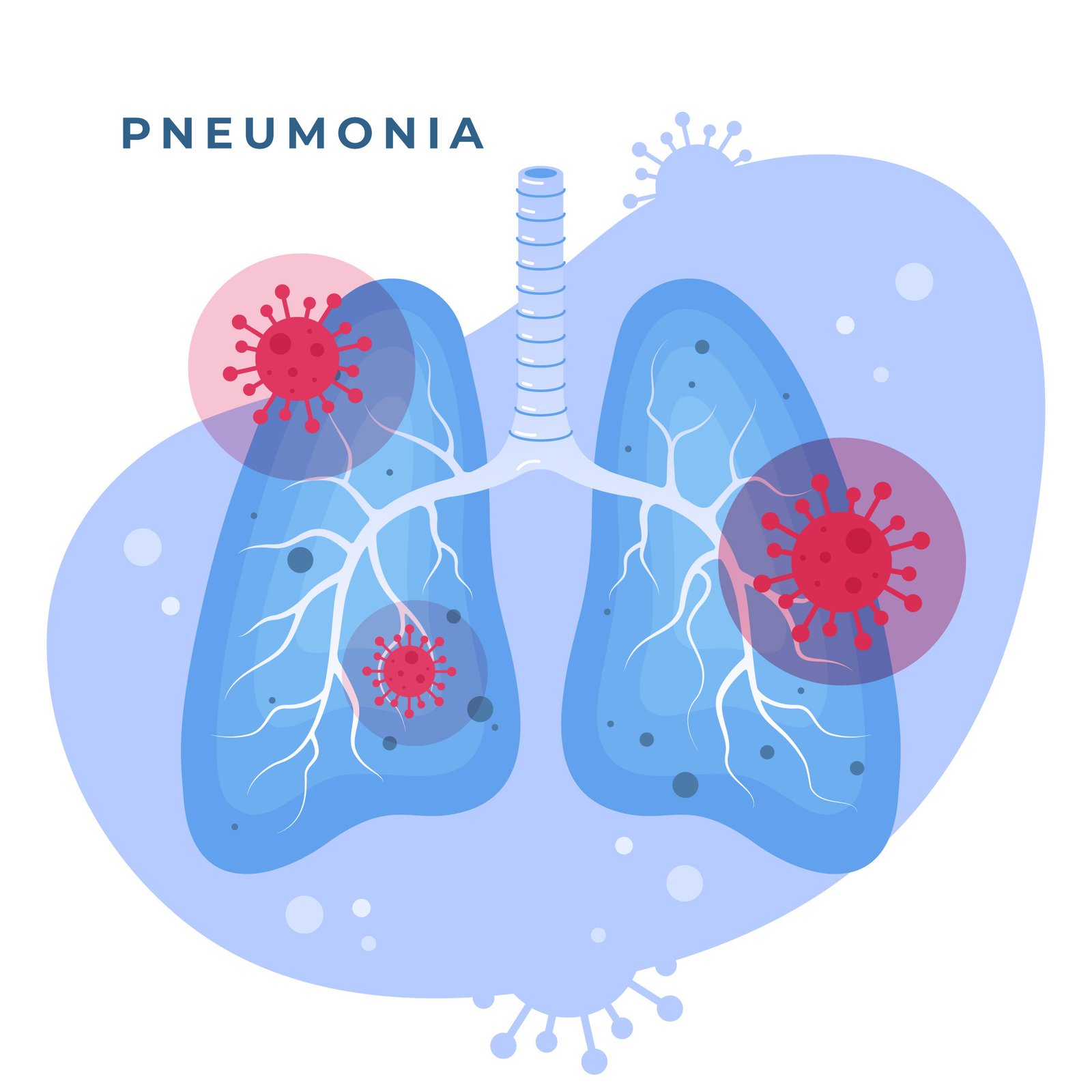 Pneumonia specialist Dr. Daksh Sharma in Bhopal