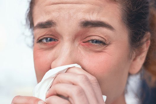Woman experiencing allergy symptoms, including watery, irritated eyes and a runny nose, while holding a tissue.