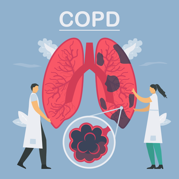 COPD medical illustration showing damaged lungs, airway changes, and healthcare professionals assessing respiratory health.
