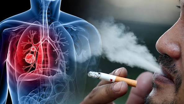 Smoker holding a lit cigarette beside a medical illustration of lungs showing smoking-related lung damage.
