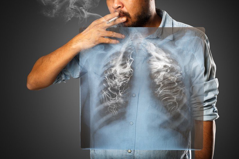 Person smoking a cigarette with a transparent lung X-ray overlay, illustrating the harmful effects of smoking on lung health.