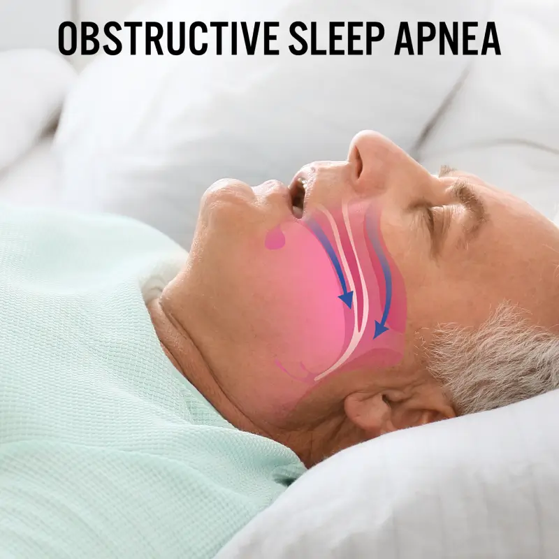 Sleep apnea diagnosis and treatment by Dr. Daksh Sharma in Bhopal